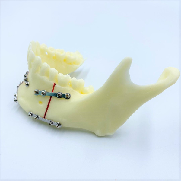 Jaw Model With Steel (A5001) - MSLI Dental Supplies