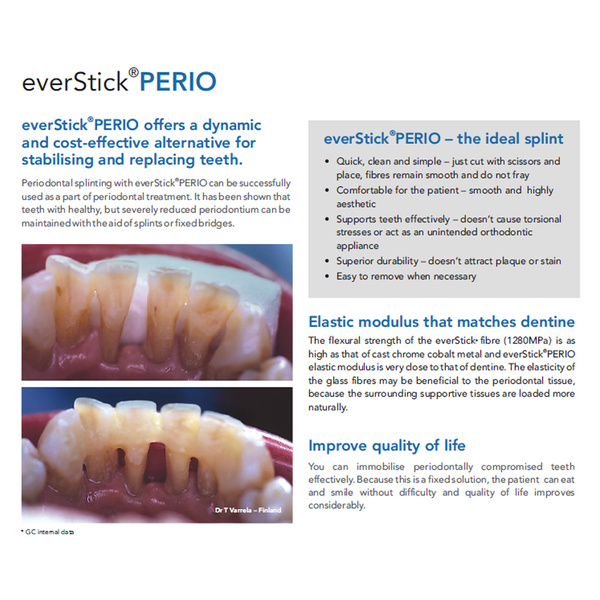 EVERSTICK PERIO - Patient Friendly Splinting - MSLI Dental Supplies