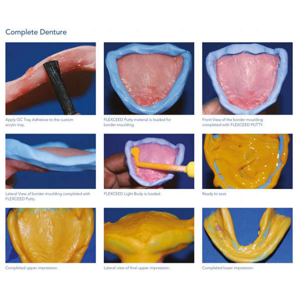 FLEXCEED PUTTY TYPE Vinyl Polysiloxane Impression Material MSLI