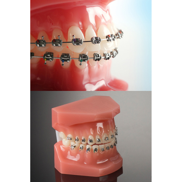 G&H MINI PREVAIL TWIN BRACKET SYSTEM MSLI Dental Supplies