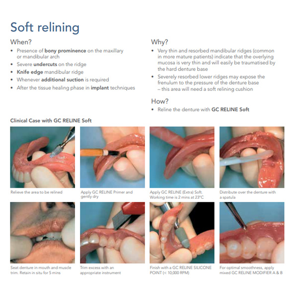 GC RELINE Soft INTRODUCTORY KIT Hard Denture, Chairside Reline