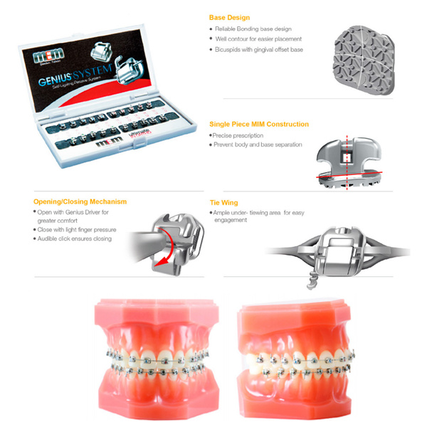 MEM GENIUS METAL BRACKET (Self Ligating Passive System) MSLI Dental